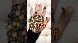 ASMR remove ticks & maggots from Hand | severely injured treatment