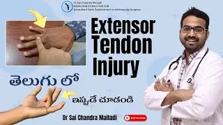 Extensor Tendon Injury Right Hand.. Explained In English n Telugu..Dr Sai Chandra