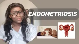 ENDOMETRIOSIS AND INFERTILITY || causes, symptoms, diagnosis and treatment of endometriosis