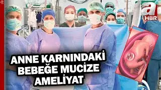 Doğmamış Bebeğe Mucize Ameliyat! | A Haber