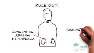 Endocrinology - Hirsutism and Hypertrichosis: By Joshua Lakoff M.D.