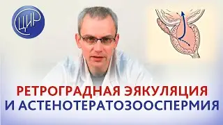 Ретроградная эякуляция и астенотератозооспермия. Что делать? Андролог ЦИР, к.м.н., Живулько А.Р.