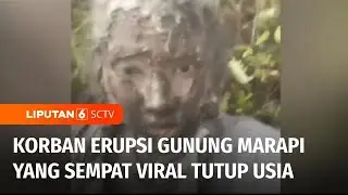 Korban Viral Erupsi Gunung Marapi Zhafira Zahrim Akhirnya Tutup Usia | Liputan 6