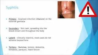 Microbiology: Spirochetes