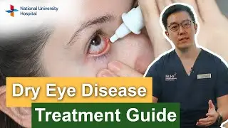 Dry eyes disease - Treatment guide