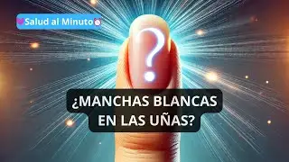 ¿PORQUE SALEN MANCHAS BLANCAS EN LAS UÑAS?