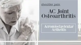 AC Joint Osteoarthritis - Acromioclavicular Arthritis