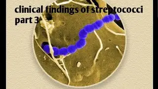 Clinical findings of streptococci | part 3