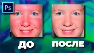 Как убрать красные пятна на коже в Фотошопе | How to remove red spots on the skin in Photoshop