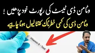 Vitamin D Test In Urdu Hindi - Dr Irfan Azeem