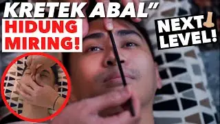 KRETEK ABAL2 HIDUNG MIRING EMANG BISA?? LANGSUNG LURUS LAGI!