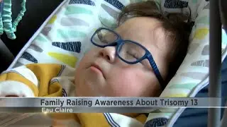 Eau Claire family raising awareness about Trisomy 13 as son celebrates 1 year home from NICU