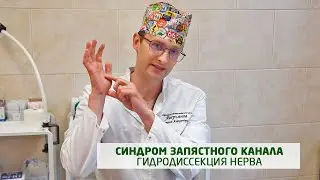 Синдром запястного канала (лечение боли)