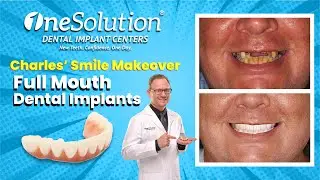 OneSolution Dental Implant Centers Charles Surgery Day
