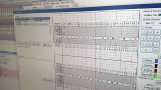 Charting Probing in a Returning Patient in Open Dental