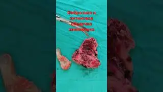 Фиброзная и хитиновая оболочка эхинококка