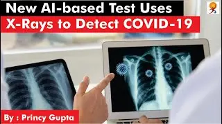 New AI-based X-ray test to detect COVID-19 in few minutes | X-ray