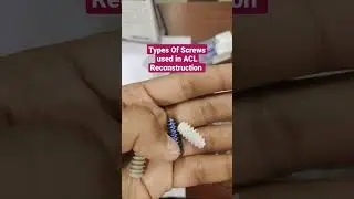 Types Of Screws(Not Anchors.. Sorry)  used in ACL Reconstruction ...Dr Sai Chandra MBBS DNB Ortho