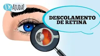 DESCOLAMENTO DE RETINA: FIQUE ATENTO!