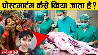 पोस्टमार्टम कैसे किया जाता है ? | पोस्टमार्टम क्या होता है ? | What is Postmortem