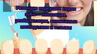 Резекция верхушки корня зуба — показания, реабилитация, возможные последствия и отзывы