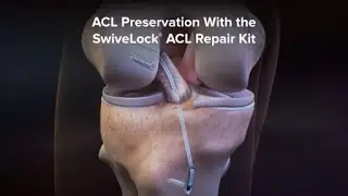 ACL Preservation With the SwiveLock® ACL Repair Kit