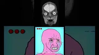 태아를 MRI로 안 찍는 이유