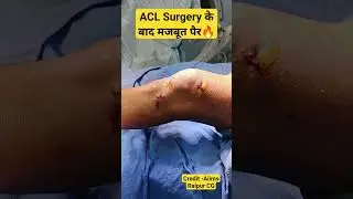 Super Strong Knee After ACL Surgery 💥#aclinjury #aclrecovery #kneeligament #anteriorcruciateligament