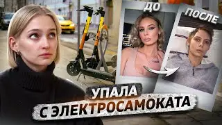 Упала с электросамоката и стала инвалидом