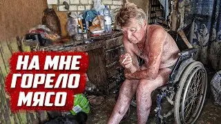 После взрыва еле выжил и теперь выживает на дачах | г. Оренбург, СНТ Сулак ул. Чехова 682