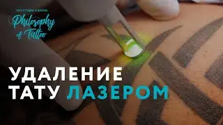 УДАЛЕНИЕ ТАТУИРОВКИ ЛАЗЕРОМ | ВСЁ О ЛАЗЕРНОМ УДАЛЕНИИ