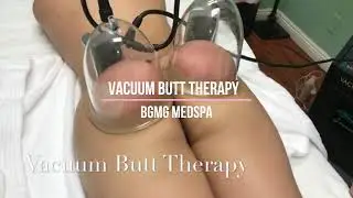 Vacuum BUTT Therapy to enlarge and tone your booty before a night out - by BGMG MEDSPA