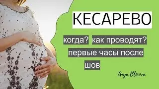 Подготовка к кесарево сечению | что нужно знать