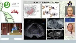 Зайцев А В, Стойлов С В - Биопсия простаты: техника и профилактика инфекционных осложнений