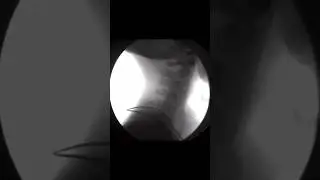 Neck mobility through X-Ray vision! 