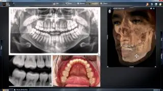 SIDEXIS 4: Setting the New Gold Standard in Dental Imaging