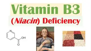 Vitamin B3 Niacin Deficiency (Pellagra) | Sources, Causes, Symptoms, Diagnosis, Treatment