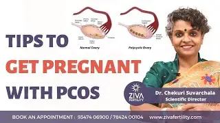 Tips to get pregnant with PCOS || PCOS and Pregnancy || Dr. Chekuri Suvarchala