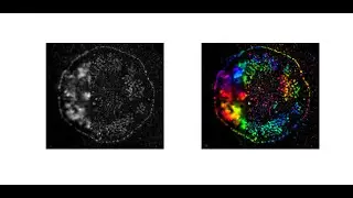 FNANO 2020: super resolution traction force orientation mapping with DNA hairpin tension probes