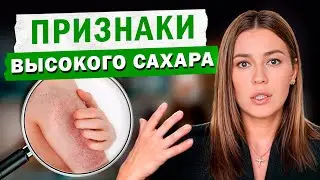 Как быстро распознать повышение САХАРА в КРОВИ? / Признаки повышенной ГЛЮКОЗЫ