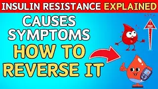 Insulin Resistance Explained | Causes, Symptoms, and How to [REVESE IT]