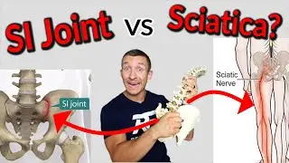 How to Fix SI Joint Pain and Sciatica! | How to Diagnose Sciatica VS SI Joint Syndrome