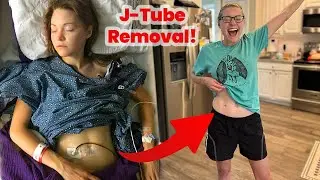 Feeding Tube Removal!!! 🎉