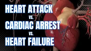 The Difference Between Cardiac Arrest, Heart Attack, and Heart Failure - 3D Animation