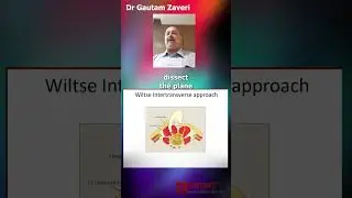 BOS Dr L N Vora Master Series : Lumbar disc prolapse special situation - Dr. Gautam Zaveri
