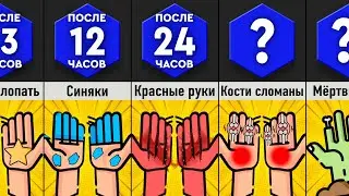 Что, Если Постоянно Хлопать в Ладоши ?