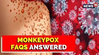 Monkeypox FAQs Answered | Monkeypox Symptoms | Monkeypox Protection | Latest News | English News