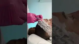Комплексное омоложение: минус 5 лет за одну процедуру!
