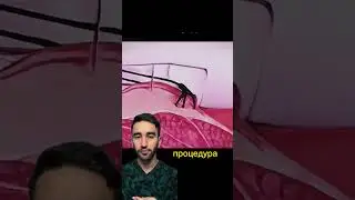 хватит молчать,  геморрой пора лечить!