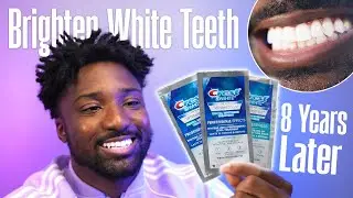 My ORAL CARE Routine - Crest 3D Whitestrips: 8 Years Later